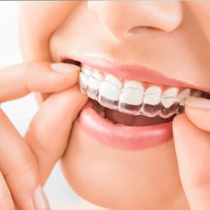 Health Benefits of Teeth Straightening